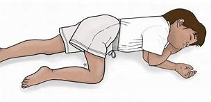 Image result for Seizure Recovery Position