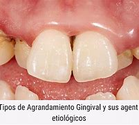 Image result for agradamienyo