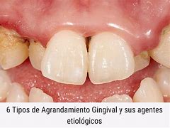 Image result for agfandamiento