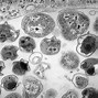 Image result for Chlamydia Under Microscope