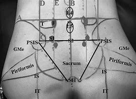 Image result for Lumbar Surface Anatomy