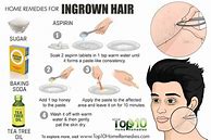 Image result for Ingrown Hair Treatment