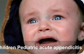 Image result for Appendicitis