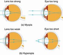 Image result for Eye Test Lenses