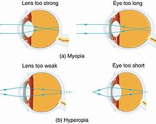 Image result for Weard Colored Eye Contact Lenses