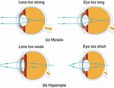 Image result for contact lenses