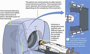 Image result for Gamma Knife Halo