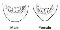 Image result for Flat Chin Implant