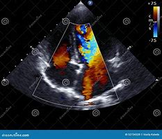 Image result for Illustration Cardiac Echocardiogram
