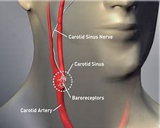 Image result for Carotid Artery Pain Left Side