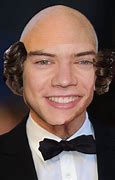 Image result for Harry Goes Bald