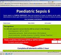 Image result for Pediatric Sepsis