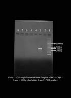 Image result for PCR Exon