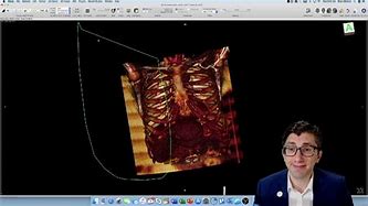 Image result for 3D Medical Scan