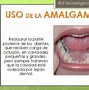 Image result for amslgamamiento