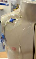 Image result for Central Venous Catheter Placement