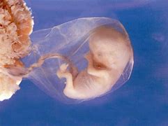 Image result for Unborn Baby