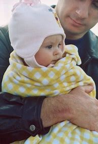 Image result for Lissencephaly