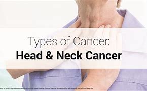 Image result for Neck Cancer Types