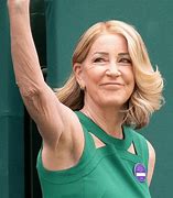 Image result for Chris Evert Plastic Surgery