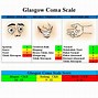 Image result for Coma Near Coma Scale