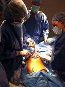 Image result for Ovarian Dermoid Cyst Removal Procedure
