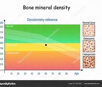 Image result for Bone Density Graph
