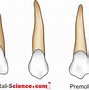 Image result for Lumbar Vertebrae Bones Shape