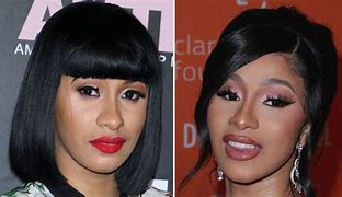 Image result for Cardi B Face Surgery