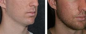 Image result for Sharp Chin Male