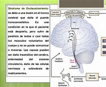 Image result for enclaustramiento