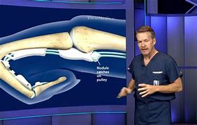 Image result for Trigger Finger Surgery Pictures