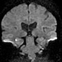 Image result for Amnesia Brain