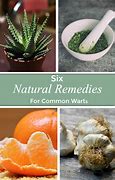 Image result for Common Wart Treatment