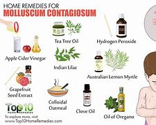 Image result for Molluscum Home Remedies