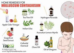 Image result for Molluscum Contagiosum Homeopathic Treatment Ointment