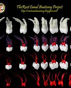 Image result for Maxillary Right Second Molar