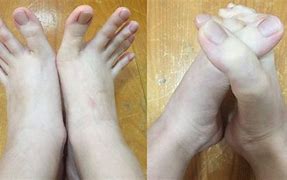 Image result for Feet Crossed Like Hands