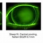 Image result for Toric Lens vs Standard Lens