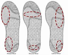 Image result for Running Shoe Wear Pattern
