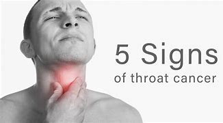 Image result for Beginning of Throat Cancer
