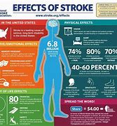 Image result for Stroke Recovery Article