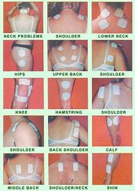 Image result for Tens Unit Pad Placement