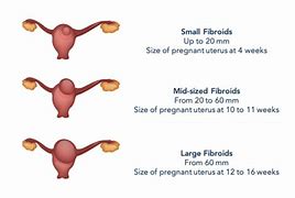 Image result for Fibroids Sizes Compared to Fruit