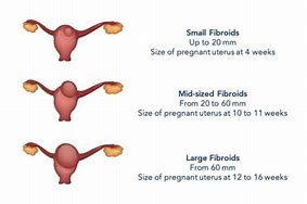 Image result for How Big Is 7 Cm Fibroid