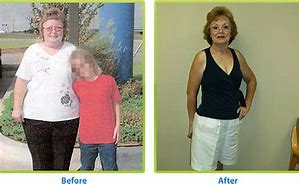 Image result for Weight Loss Before and After