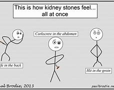 Image result for Kidney for iPhone Meme