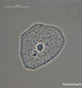 Image result for Clue Cells Urine Microscopic