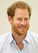 Image result for Prince Harry's Hair Transplant