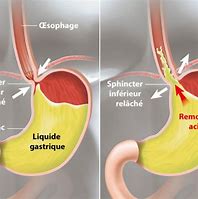 Image result for Liquid E Gastrique